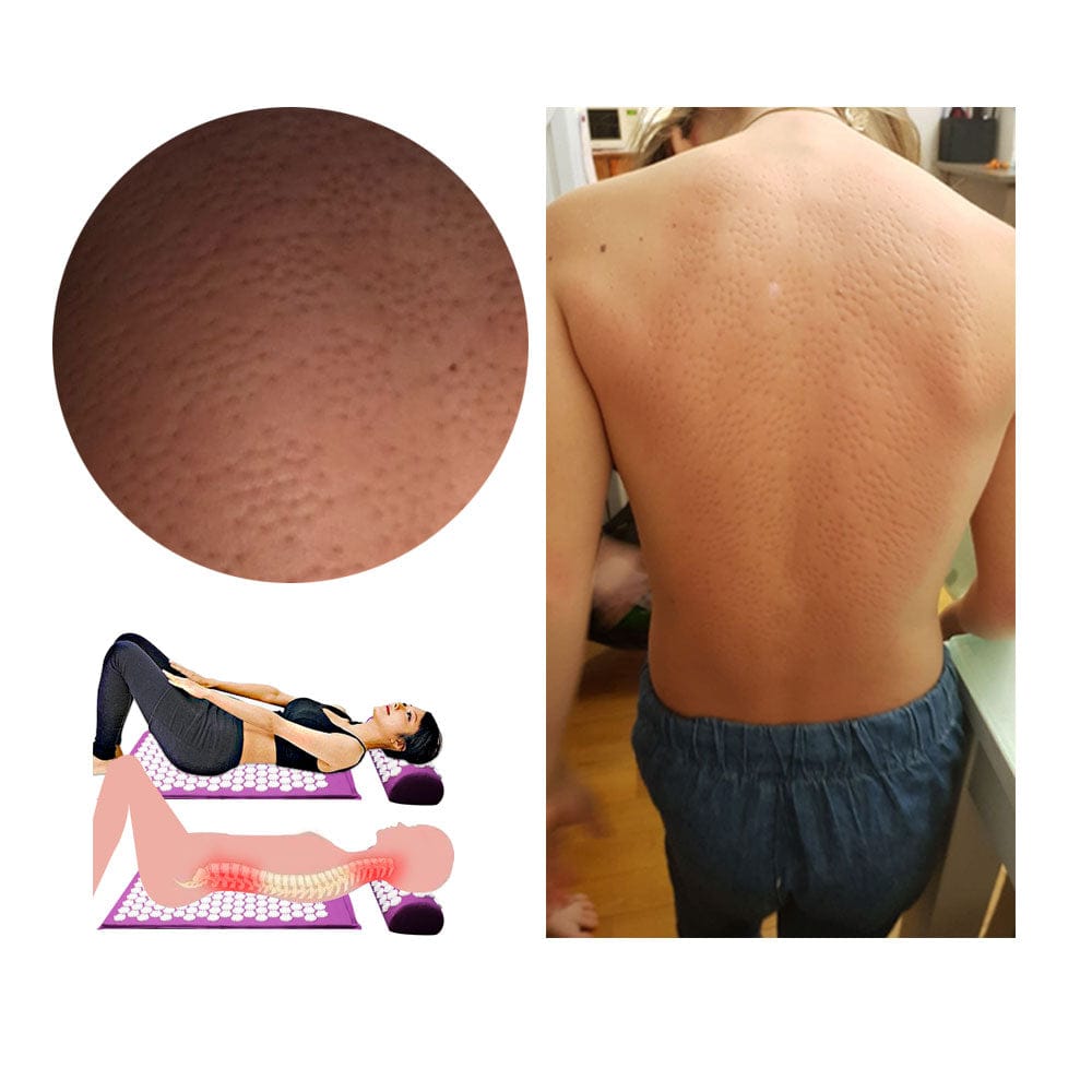 Pavoco Akupressurmatten Entspannende Akupressurmatte für Unisex mit Druckpunkten und Kissen vielseitig