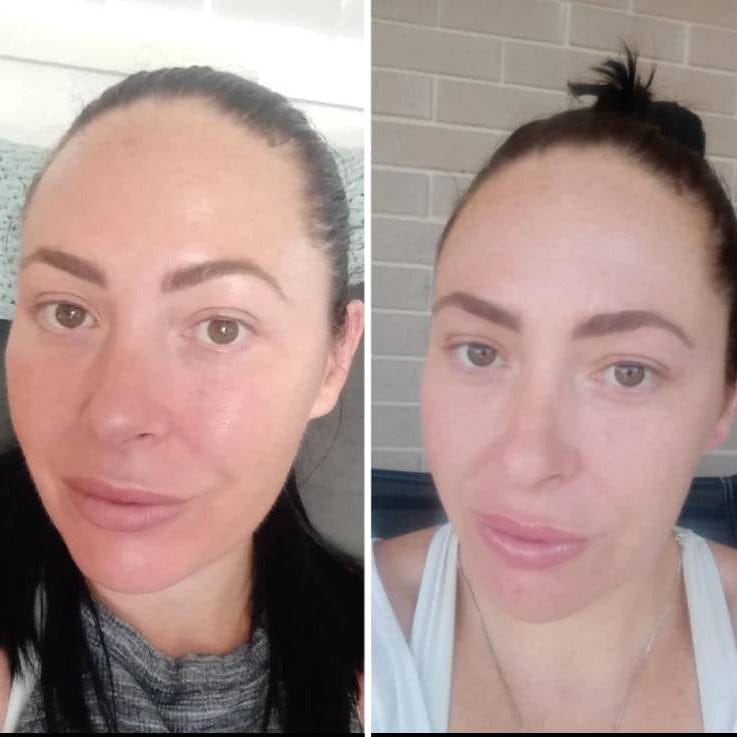 Pavoco Gesichtsmasken Default Effektive LED Gesichtsmaske für Damen alle Hauttypen schnell wirkend Falten reduzieren