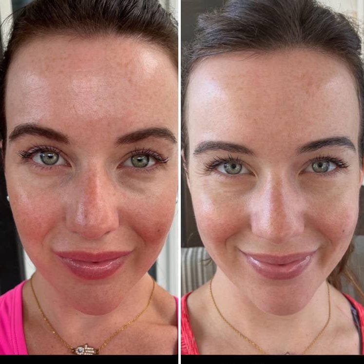 Pavoco Gesichtsmasken Default Effektive LED Gesichtsmaske für Damen alle Hauttypen schnell wirkend Falten reduzieren